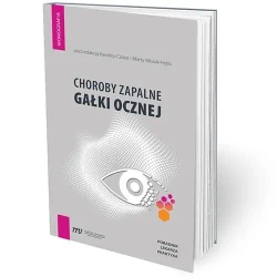 Choroby zapalne gałki ocznej - poradnik lekarza pr - praca zbiorowa