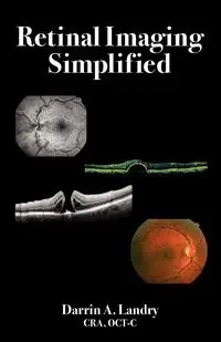 Retinal Imaging Simplified - Darrin Landry