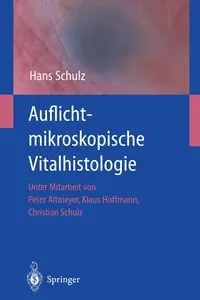 Auflichtmikroskopische Vitalhistologie - Hans Schulz