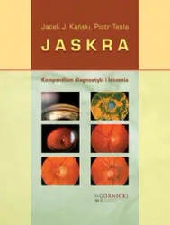 Jaskra. Kompendium diagnostyki i terapii - Jacek J. Kański, Piotr Tesla