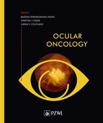 Ocular Oncology - Bożena Romanowska-Dixon