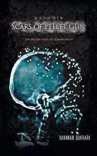 Kashmir - Scars of Pellet Gun - Bukhari Mannan