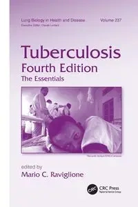 Tuberculosis - Raviglione Mario C.