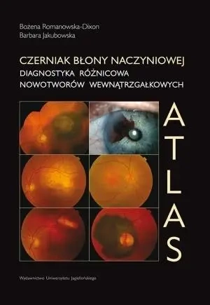 Czerniak błony naczyniowej. Diagnostyka różnicowa - Bożena Romanowska-Dixon, Barbara Jakubowska