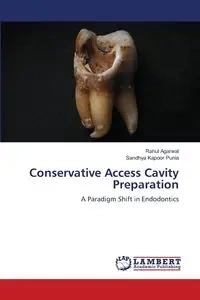 Conservative Access Cavity Preparation - Agarwal Rahul