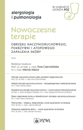 Nowoczesne terapie obrzęku naczynioruchowego... - Ewa Czarnobilska, Marcel Mazur