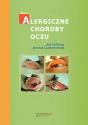 Alergiczne choroby oczu - red. Janusz Czajkowski