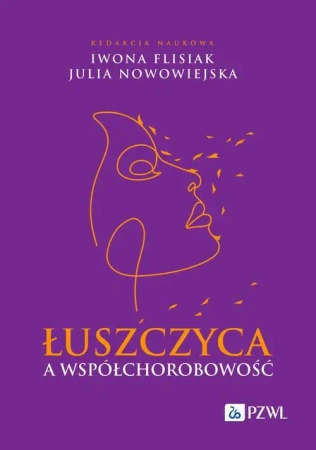 eBook Łuszczyca a współchorobowość - Iwona Flisiak mobi epub