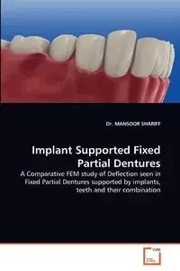 Implant Supported Fixed Partial Dentures - Shariff Mansoor