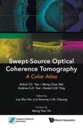 SWEPT-SOURCE OPTICAL COHERENCE TOMOGRAPHY - KELVIN WAI ANDREW Y C TEO CHEE WONG S