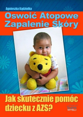 Oswoić atopowe zapalenie skóry - Agnieszka Kądziołka