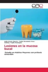 Lesiones en la mucosa bucal - Alvelo Chacón Adlin