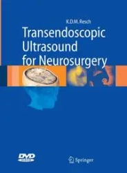 Transendoscopic Ultrasound for Neurosurgery - Maria Resch Klaus Dieter