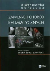 Diagnostyka obrazowa zapalnych chorób.. - praca zbiorowa