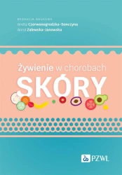 Żywienie w chorobach skóry - Aneta Czerwonogrodzka-Senczyna, Anna Zalewska-Jan