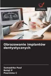 Obrazowanie implantów dentystycznych - Paul Samadrita