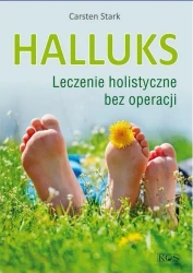 Halluks. Leczenie holistyczne bez operacji - Carsten Stark