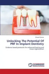 Unlocking The Potential Of PRF In Implant Dentistry - Parmar Dhvani