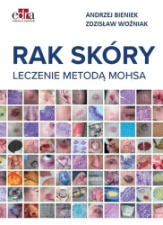 Rak skóry. Leczenie metodą Mohsa - Andrzej Bieniek, Zdzisław Woźniak
