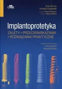 Implantoprotetyka Zalety przeciwwskazania rozwiązania praktyczne - Bruna Ezio, Andrea Fabianelli, Pavolucci Giulio