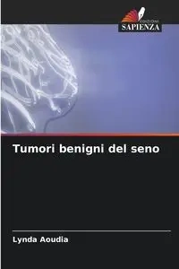 Tumori benigni del seno - Lynda Aoudia