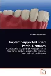Implant Supported Fixed Partial Dentures - Shariff Mansoor
