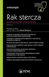Rak stercza. Współczesne spojrzenie - Paweł Wiechno