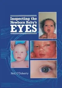 Inspecting the Newborn Baby's Eyes - O'Doherty N.