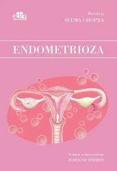 Endometrioza - S Chopra