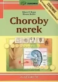 Choroby nerek - Klaus F. Kopp, Hanne Keller