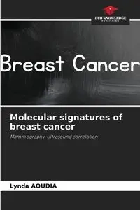 Molecular signatures of breast cancer - Lynda Aoudia