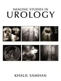 Imaging Studies in Urology - Samhan Khalil-Ahmad