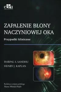 Zapalenie błony naczyniowej oka - Sandhu H.S., Kaplan H.J.