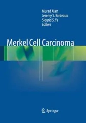 Merkel Cell Carcinoma - Alam Murad