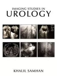 Imaging Studies in Urology - Samhan Khalil-Ahmad