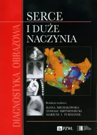 Diagnostyka obrazowa Serce i duże naczynia - Tomasz Hryniewiecki, Ilona Michałowska, Mariusz I
