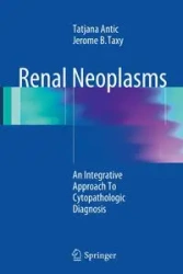 Renal Neoplasms - Antic Tatjana