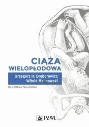 Ciąża wielopłodowa - Grzegorz H Bręborowicz, Witold Malinowski