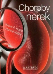 Choroby nerek - Hanne Keller