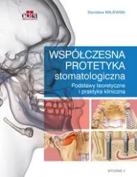 Współczesna protetyka stomatologiczna - Majewski S.
