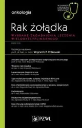 Rak żołądka - praca zbiorowa