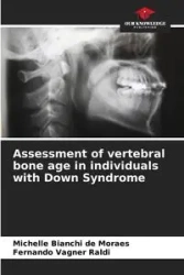 Assessment of vertebral bone age in individuals with Down Syndrome - Michelle Bianchi de Moraes