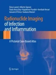 Radionuclide Imaging of Infection and Inflammation - Elena Lazzeri