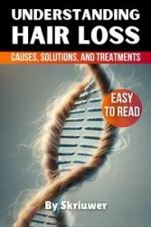 Understanding Hair Loss in Men - Skriuwer.com