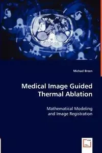 Medical Image Guided Thermal Ablation - Michael Breen