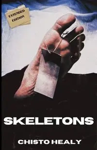 Skeletons - Healy Chisto