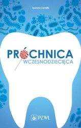 Próchnica wczesnodziecięca - Joanna Zemlik