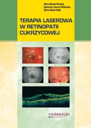 Terapia laserowa w retinopatii cukrzycowej - praca zbiorowa