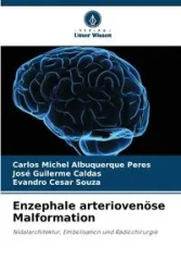 Enzephale arteriovenöse Malformation - Carlos Michel Albuquerque Peres