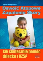 Oswoić atopowe zapalenie skóry - Agnieszka Kądziołka